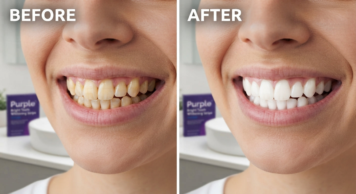 What makes the DRDENT Purple Teeth Whitening Strips Worth Buying